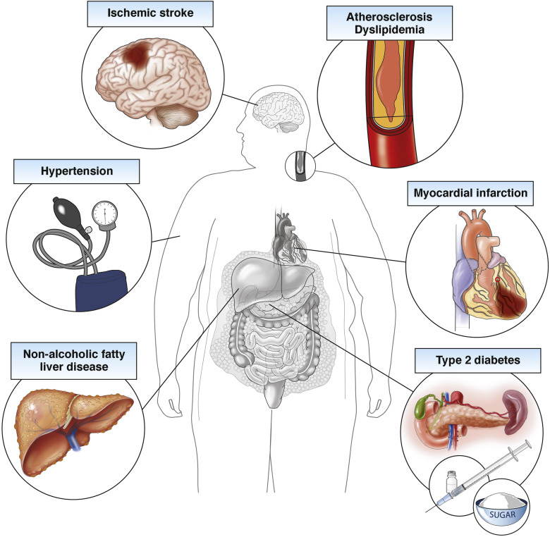 Medical Consequences of Obesity